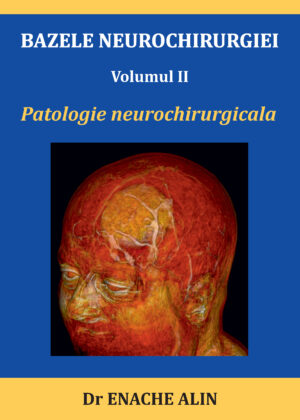 BAZELE NEUROCHIRURGIEI: Volumul II Patologie neurochirurgicala