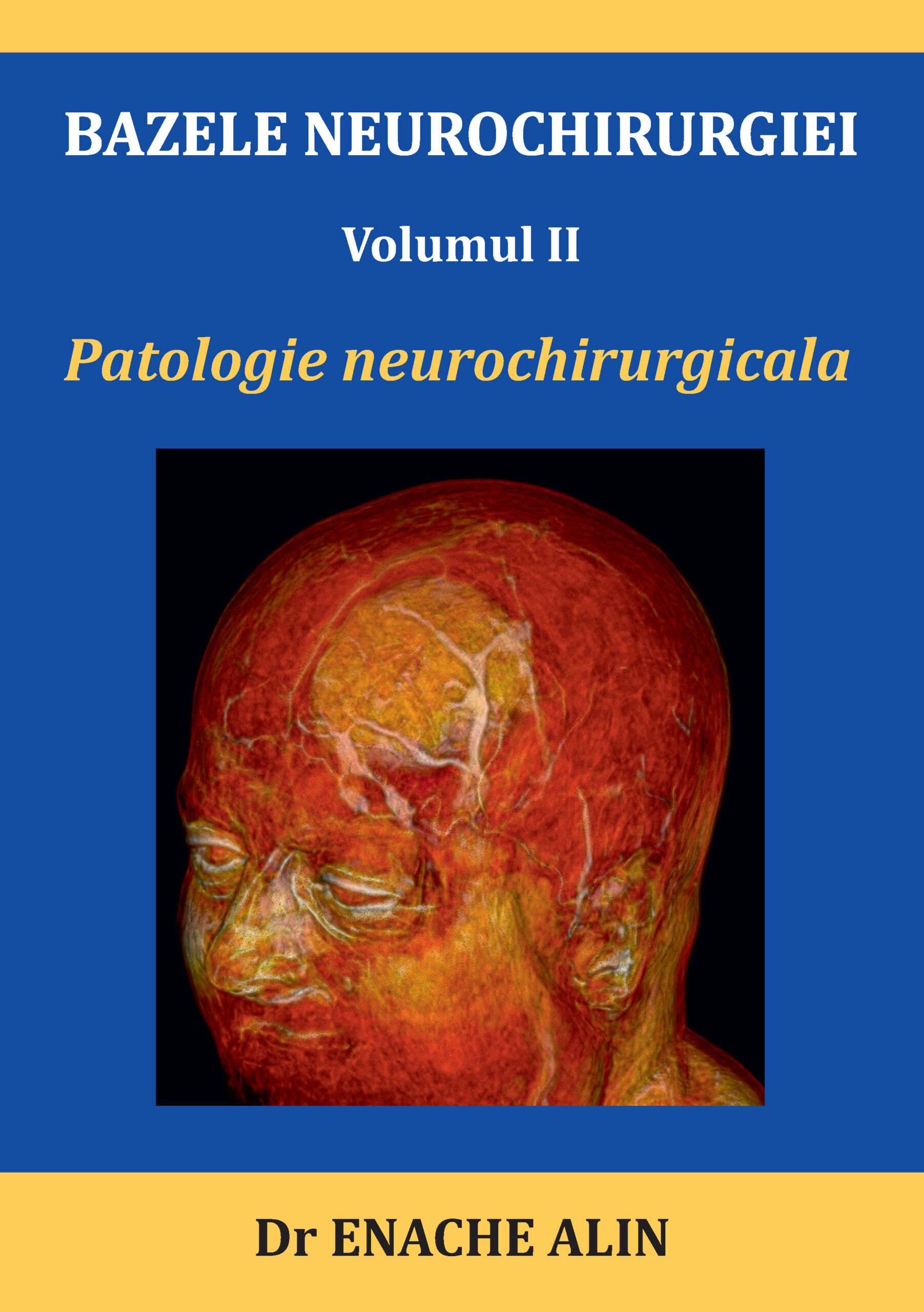 BAZELE NEUROCHIRURGIEI: Volumul II Patologie neurochirurgicala